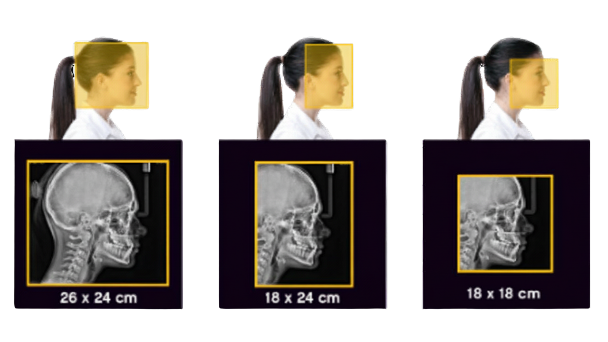 Formatos de imagen cefalométrica: 26 × 24 cm, 18 × 24 cm y 18 × 18 cm